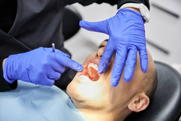 Best Dentist for Tooth Abscess  in Abram, TX